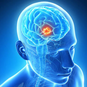 these symptoms shows that you have brain tumor